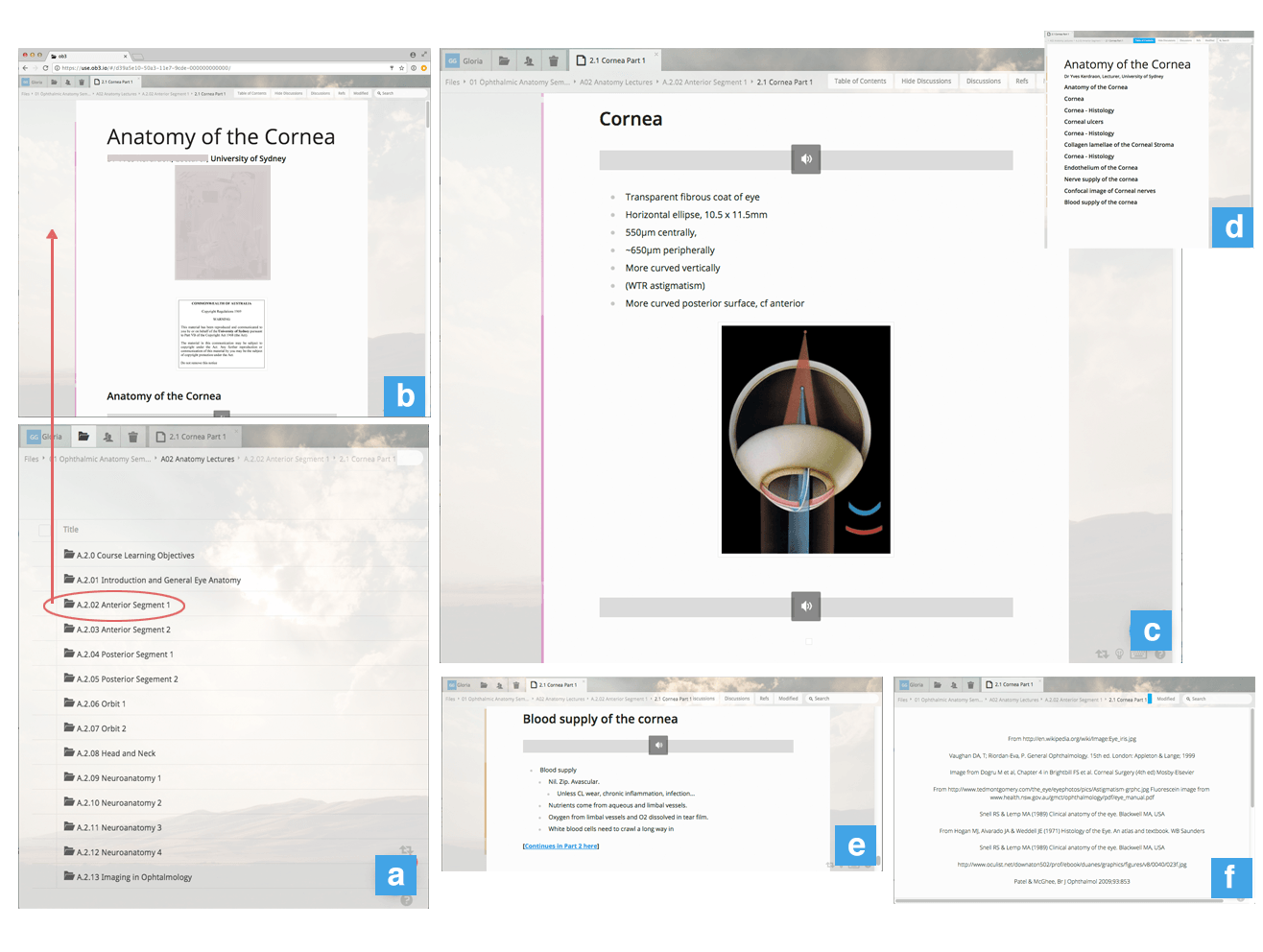 Figure sourced from Gomez et al. 2017. It presents sections of a lecture document on an ophthalmology paper in anatomy. The title is Anatomy of the cornea. The figure is created with screenshots of 6 sections of the documents, highilighting features.